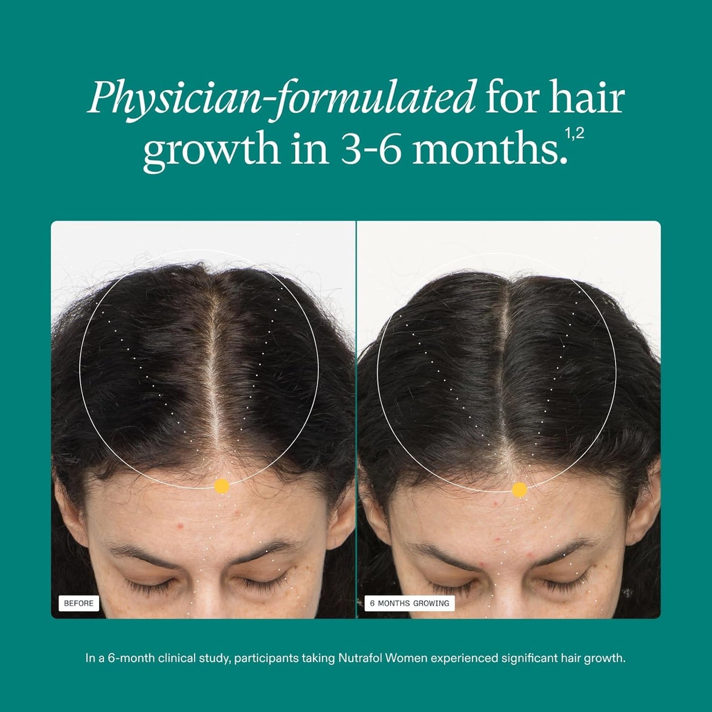 Nutrafol Women's Hair Growth Supplements, Ages 18-44, Clinically Proven for Visibly Thicker and Stronger Hair, Dermatologist Recommended - 1 Month Supply